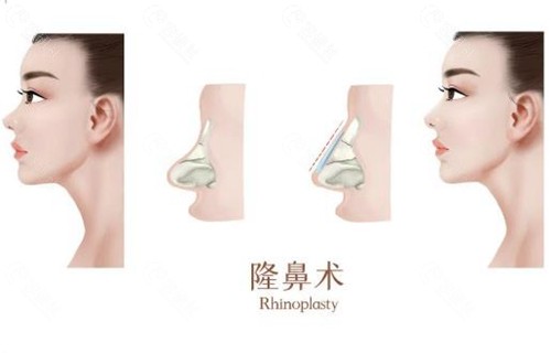 吴辉