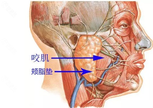 去颊脂垫价格