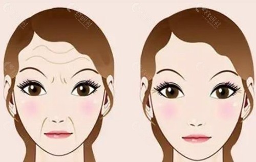 童颜光微提价格是多少？