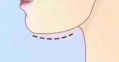 景熙翔