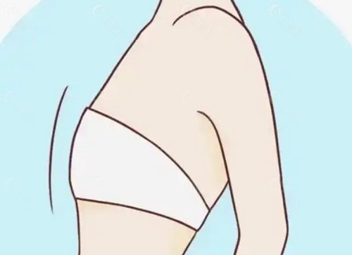 平胸手术哪家医院可以做？