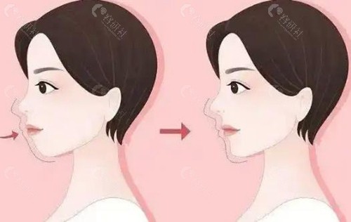 沈绍勇7d榫卯技术轮廓提升怎么样？