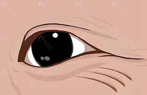眼周筋膜提升价格是多少？