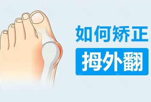 大脚骨手术的费用大概是多少
