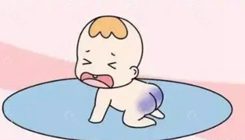 去胎记费用一般多少钱？