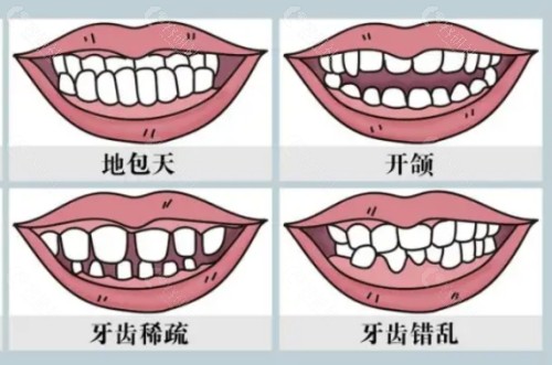 宁波海曙雅艺口腔门诊部颌面整形优势介绍