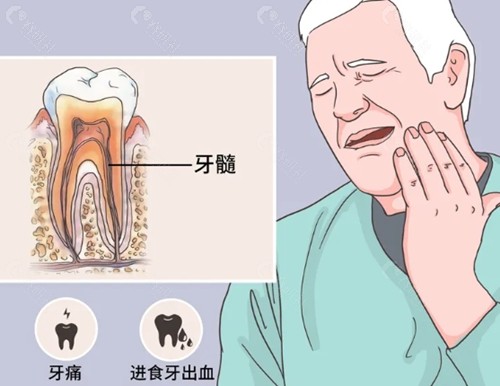 根管治疗能刷医保吗