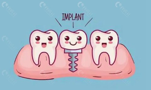 郑州医院牙科种植牙价格表