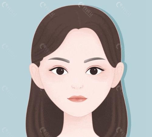 微孔定位提升术技术原理与特点