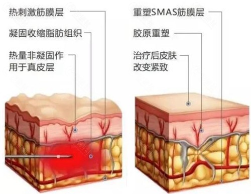 北京钻石微雕好的认证医院名单