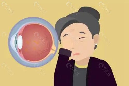 视神经萎缩治疗价格是多少？
