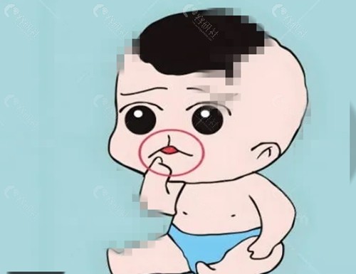 成都友谊赵延峰唇腭裂修复好吗