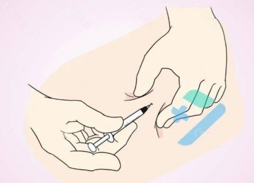 取出鼻子注射物价格表