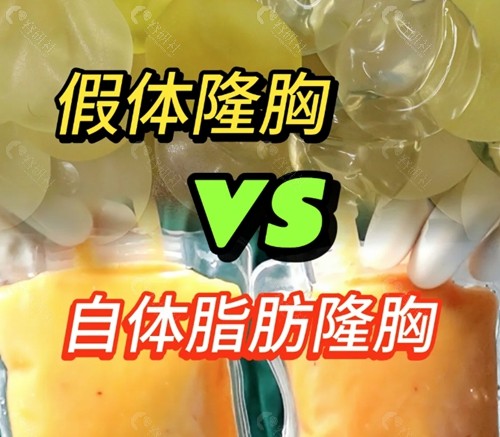 抽脂丰胸和假体隆胸哪个效果好