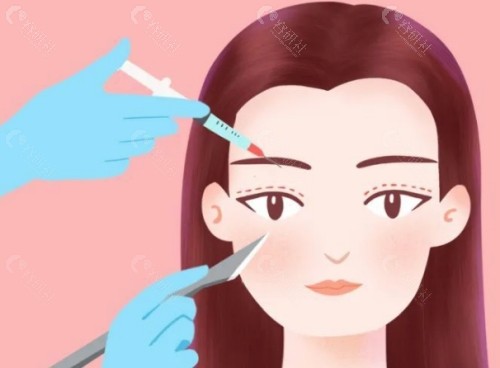 兰州维多丽亚整形眼整形医生谁的技术好？