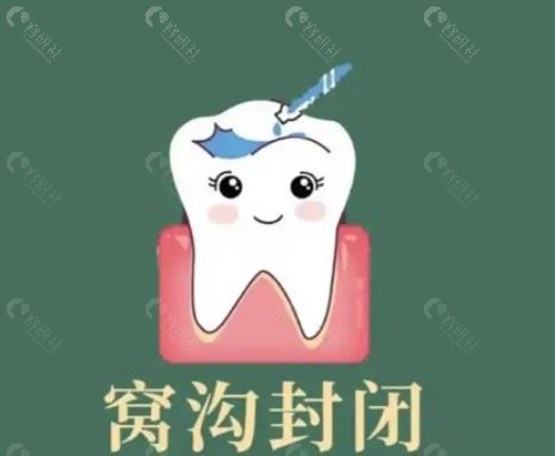 窝沟封闭是免费的还是收费的？