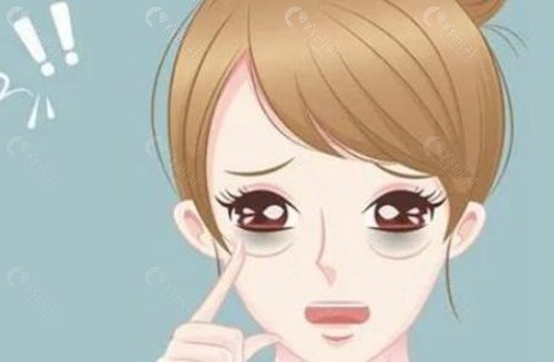 不同方法去黑眼圈收费价格