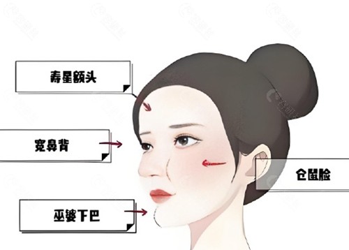 国内馒化修复口碑好的医生