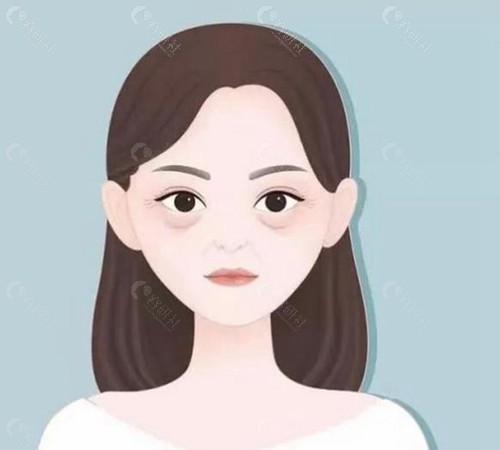 沈阳祛眼袋手术得多少钱？