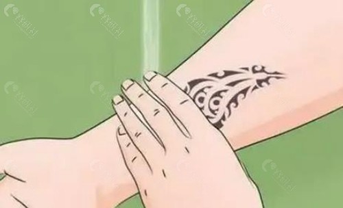 激光洗纹身注意细节