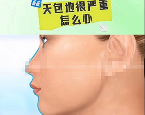 天包地矫正方法有哪些
