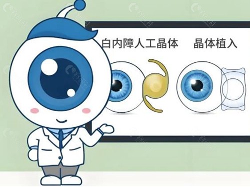 白内障手术人工晶体越贵越好吗？