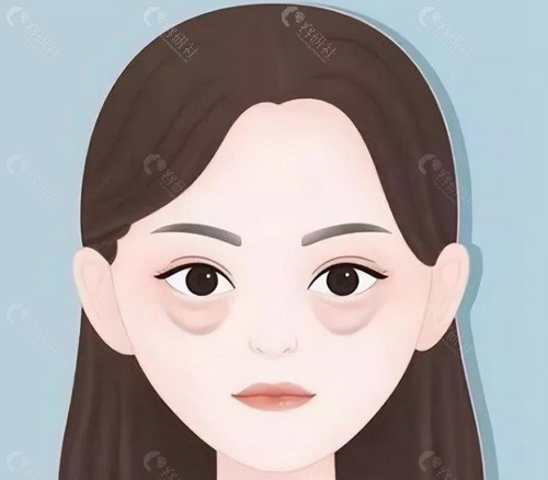 2025汉中去眼袋手术价格一览
