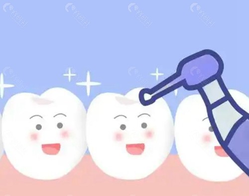 成都牙科洗牙价格