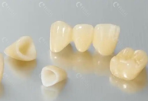 低价全瓷牙有什么猫腻？