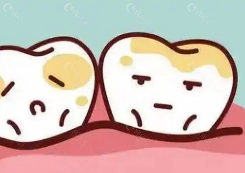 四环素牙50岁以后可以治吗？