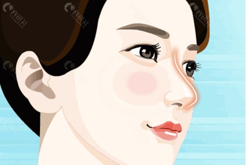 淄博美之元隆鼻好吗