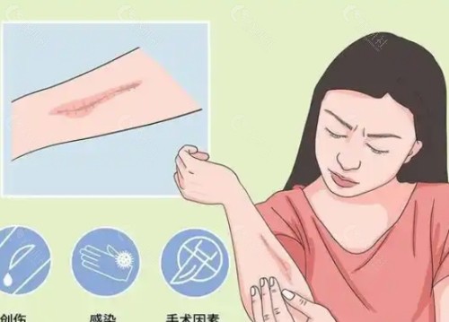 许昌星梵祛疤怎么样？
