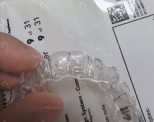 隐适美换新牙套没有感觉是不是不匹配