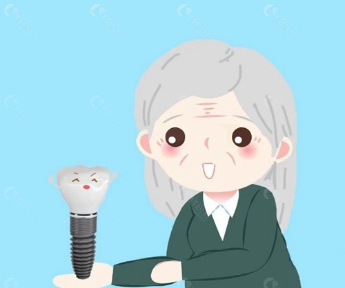 2980元种植牙：相对合理一些
