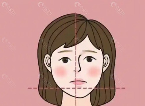 面部不对称、脸歪矫正