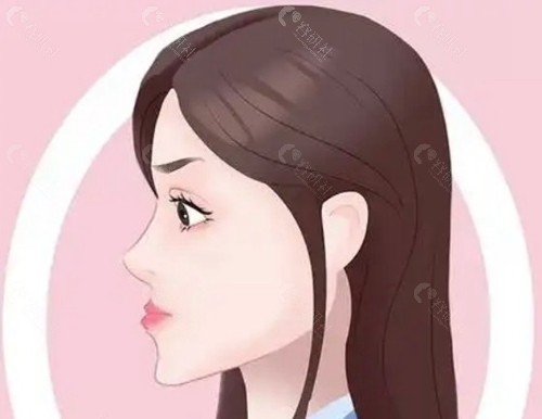 地包天矫正