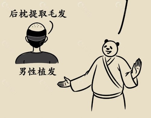 合肥植发价格表