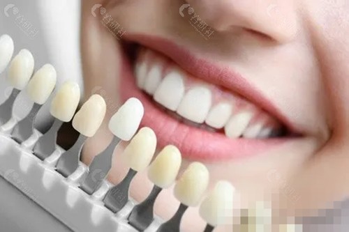 汉中艾牙美口腔正规吗
