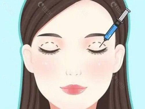 眼角修复