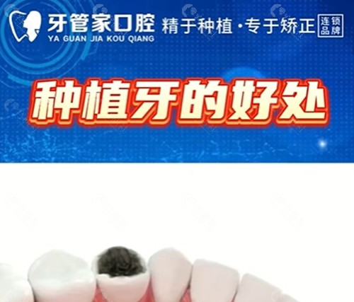 随州牙管家口腔种植牙好吗