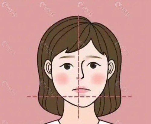 正颌手术之前为什么要正畸？