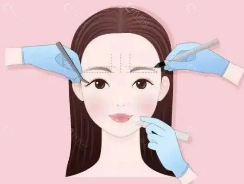 庆阳美立方医疗美容怎么样？