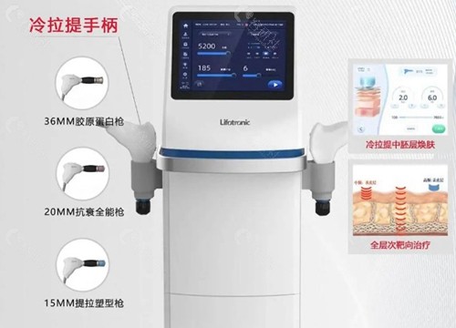 冷拉提面部提升什么原理？
