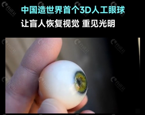 3d人工眼球适合哪些人？