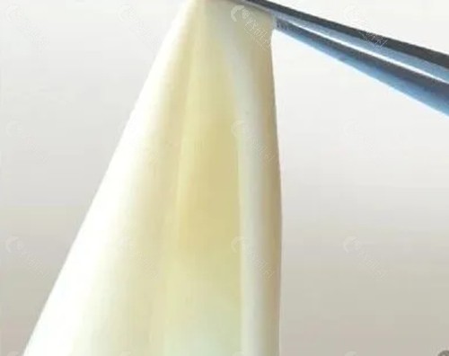 生物补片增粗价格