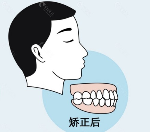 2025汕尾牙齿矫正价格表