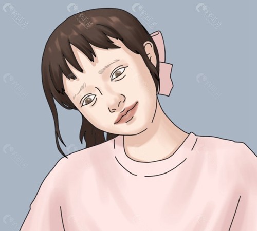斜视手术是全麻还是局麻？