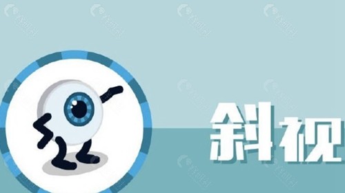 斜视手术可以只做单眼吗？