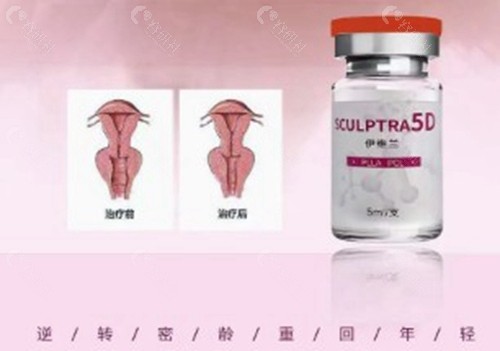 伊维兰5D童颜针私密注射怎么做？