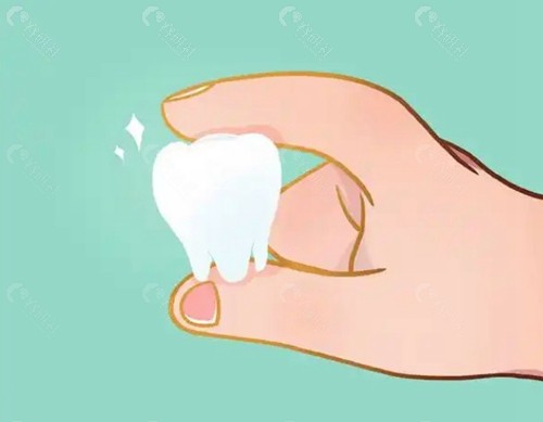白牙吖全瓷贴面真的好吗？
